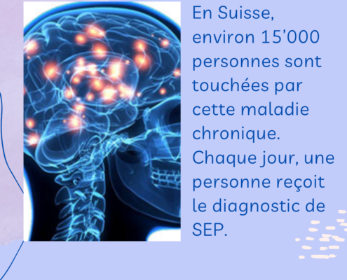 Sclerose-en-plaques-quel-age