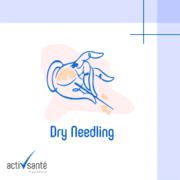dry-needling-ou-trouver-geneve