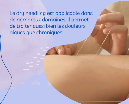 dry-needling-vs-acupuncture