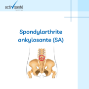 Spondylarthrite-ankylosante-soulager-naturellement-soigner