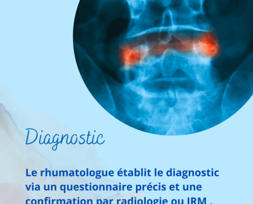 Spondylarthrite-ankylosante-symptomes-qui-consulter-crise-que-faire