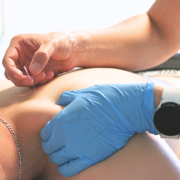 dry-needling-geneve-rive-activ-sante-physio-physiotherapie-formation