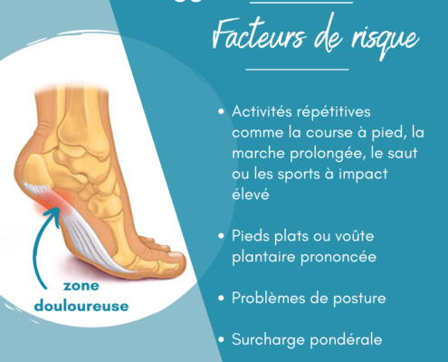 fasciapathie-plantaire-activ-sante-voute-pied-geneve-3-facteurs-risque